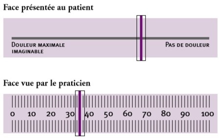 https://www.sfetd-douleur.org/wp-content/uploads/2019/09/Echelle-visuelle-analogique2.jpg