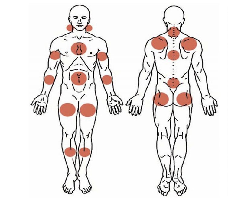 Score diagnostic